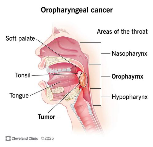 My Cancer Diagnosis